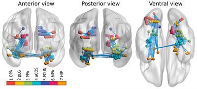 Tackling the challenges of group network inference from intracranial EEG data